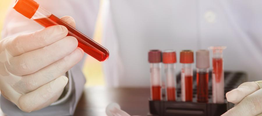 Test tubes in gloved hands